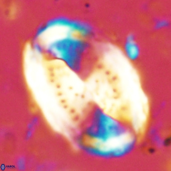 Pontosphaera sparsiforata VR 6896