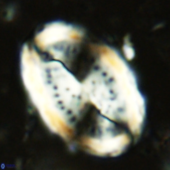 Pontosphaera sparsiforata VR 6897