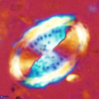 Pontosphaera sparsiforata VR 6900