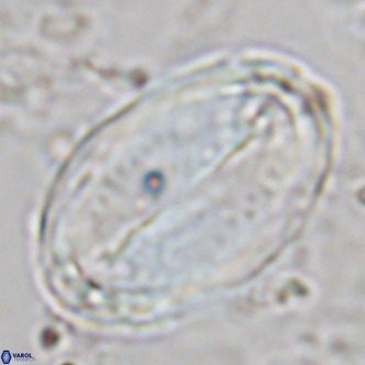 Pontosphaera sparsiforata VR 6901