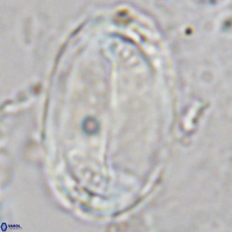 Pontosphaera sparsiforata VR 6903