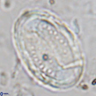 Pontosphaera sparsiforata VR 6904