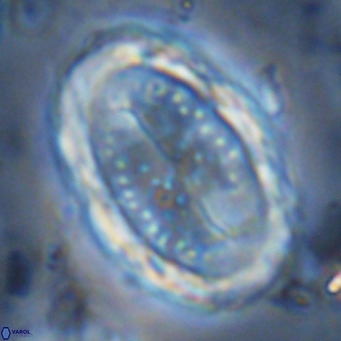 Pontosphaera sparsiforata VR 6905