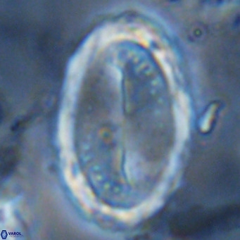Pontosphaera sparsiforata VR 6906