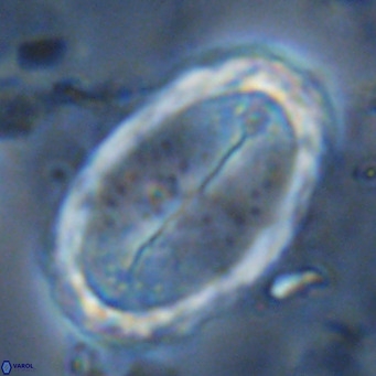 Pontosphaera sparsiforata VR 6907
