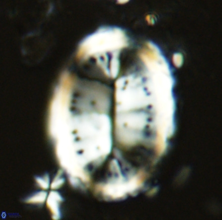 Pontosphaera sparsiforata VR 6920