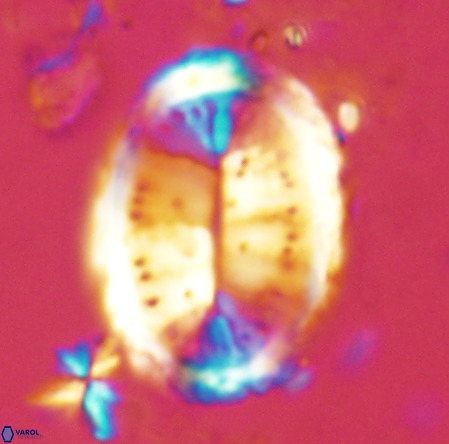 Pontosphaera sparsiforata VR 6921