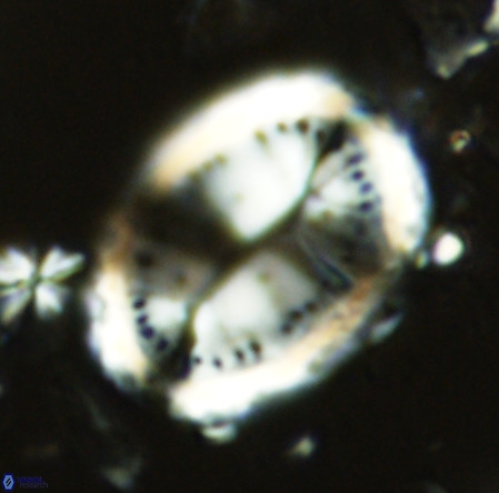 Pontosphaera sparsiforata VR 6924