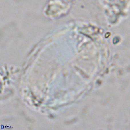 Pontosphaera sparsiforata VR 6926