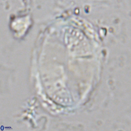 Pontosphaera sparsiforata VR 6927