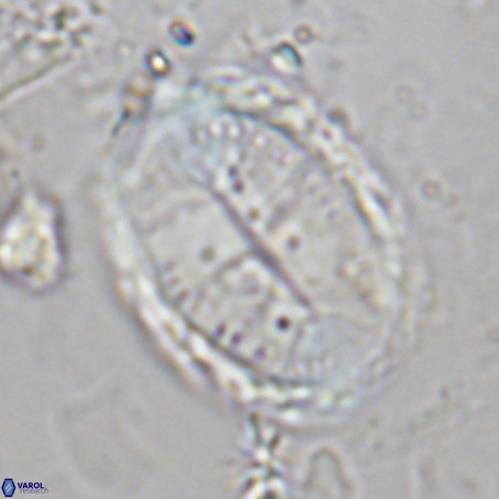 Pontosphaera sparsiforata VR 6928