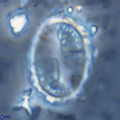 Pontosphaera sparsiforata VR 6931