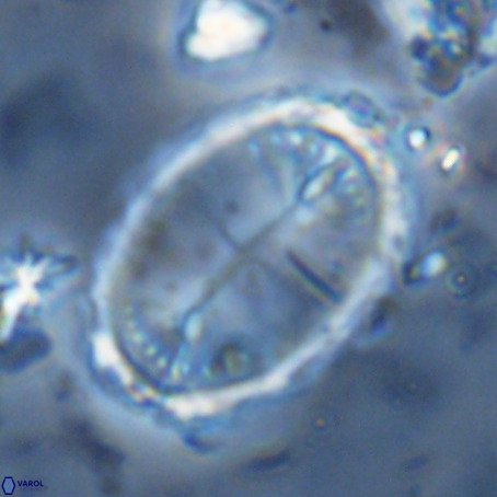 Pontosphaera sparsiforata VR 6932