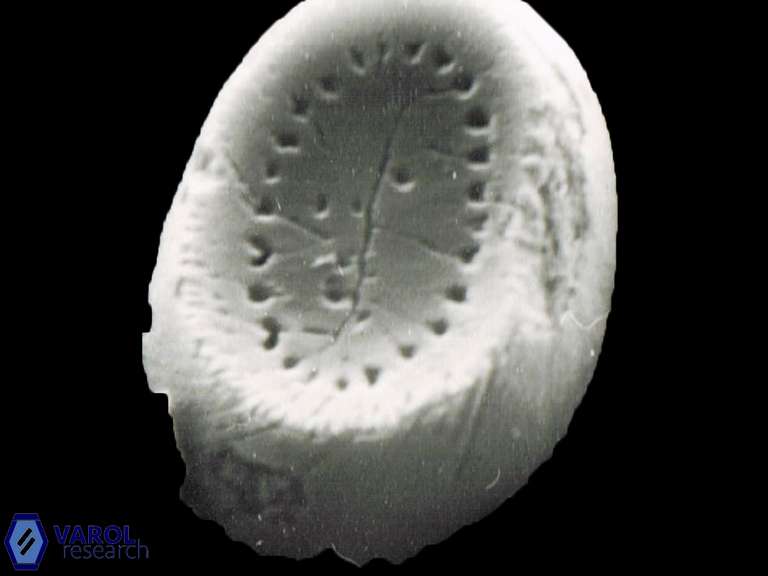 Pontosphaera sparsiforata 1149 12