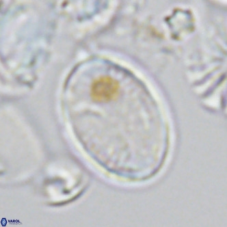 Pontosphaera paynei VR 5190