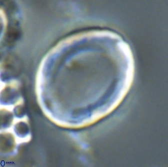 Pontosphaera rimosa 20130