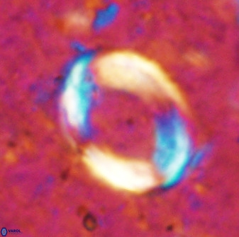 Pontosphaera rimosa 49759
