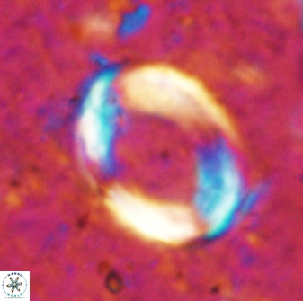 Pontosphaera rimosa 49759