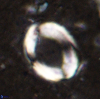 Pontosphaera rimosa 49760