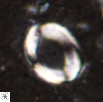 Pontosphaera rimosa 49760