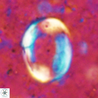 Pontosphaera rimosa 49762