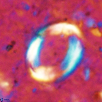 Pontosphaera rimosa 49763