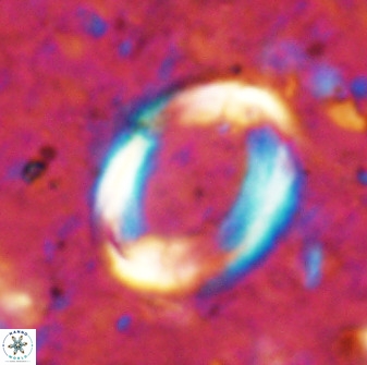 Pontosphaera rimosa 49763