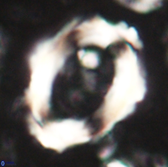 Pontosphaera rimosa 60277