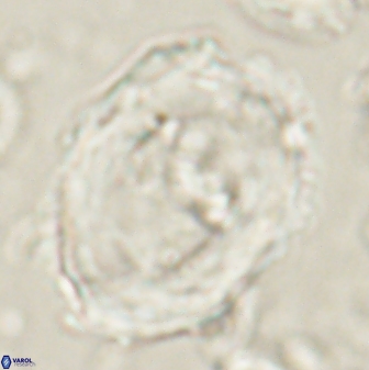 Pontosphaera rimosa 60278