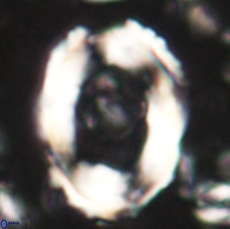 Pontosphaera rimosa 60273