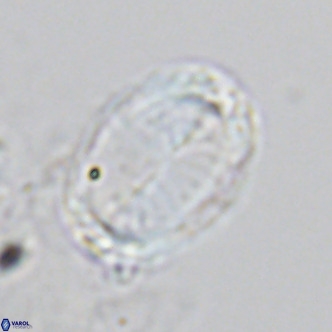 Pontosphaera trena VR 6884