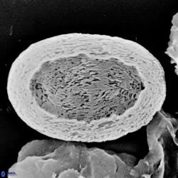 Pontosphaera versa