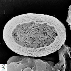 Pontosphaera versa