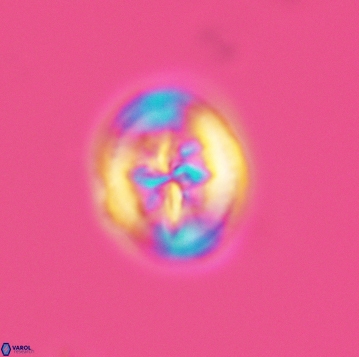 Heterorhabdus angustiforatus 3740