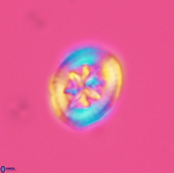 Heterorhabdus angustiforatus 3738