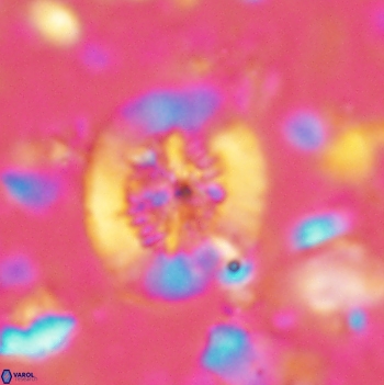 Polypodorhabdus escaigii 2104