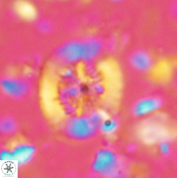 Polypodorhabdus escaigii 2104