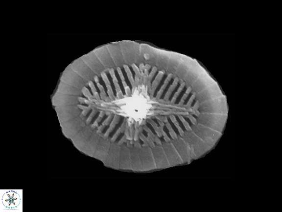 Polypodorhabdus sp 3 Bown Cooper SEM a jpg