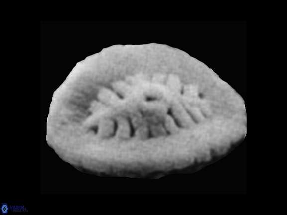 Polypodorhabdus sp 2 SEM Grun Zweili a