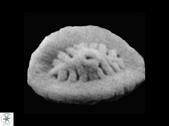 Polypodorhabdus sp 2 SEM Grun Zweili a