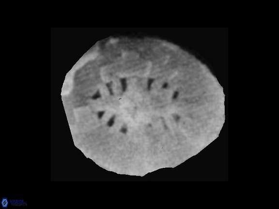 Polypodorhabdus 1 Grun Zwelii SEM a