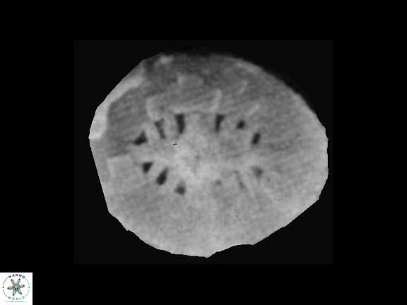 Polypodorhabdus 1 Grun Zwelii SEM a