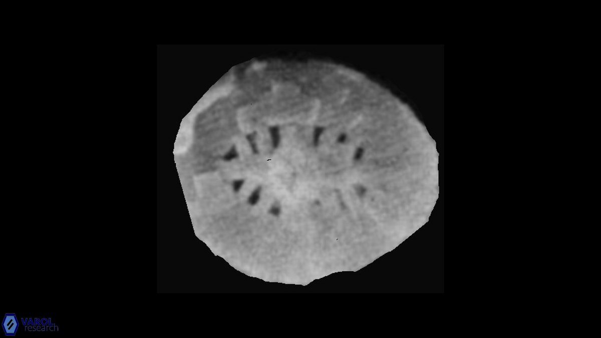 Polypodorhabdus 1 Grun Zwelii SEM a