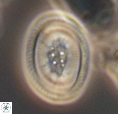 Pollicenotas constrictus 10472