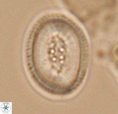 Pollicenotas constrictus 10473