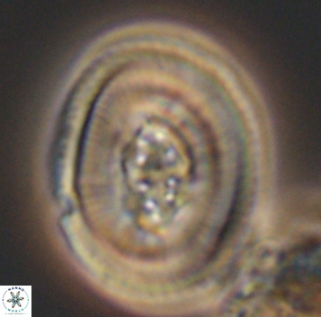 Pollicenotas constrictus 10294