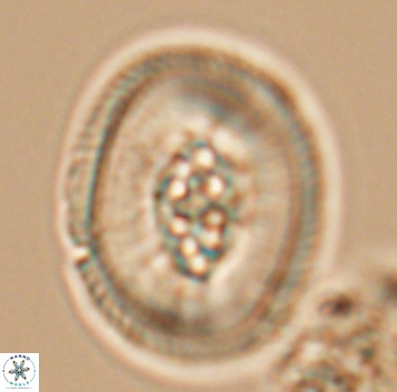 Pollicenotas constrictus 10295