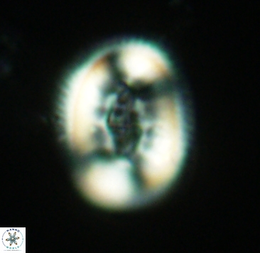 Pollicenotas constrictus 4051
