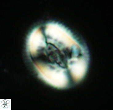Pollicenotas constrictus 4054