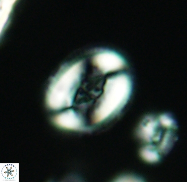Pollicenotas constrictus 4223